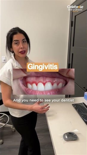 If Your Gums Bleed When Brushing… Watch This #celebratedental #shorts