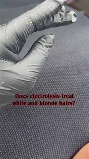 Electrolysis for White and Blonde Hair: Facts You Need to Know