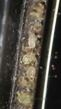 Micrscope using Imaging Things #facts #bacteria