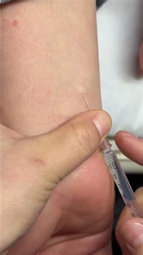 Intramuscular Injection Technique Explained | Safe IM Injection Step-by-Step | Nurse Guide Class 10