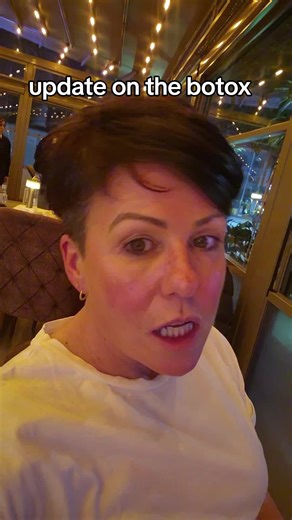 Botox Update: Day 2 Progress Report