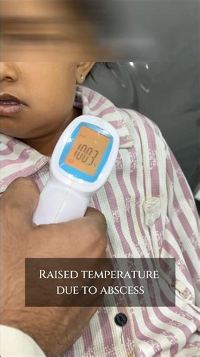 Raised Temperature due to abscess