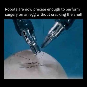 Robots Are So Advanced They Can Now Perform Surgery On An Egg Without Breaking It