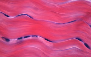 Bachelor of Health Sciences / Master of Occupational Therapy