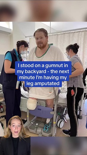 Man's Life-Threatening Infection After Stepping on a Gum Nut Leads to Leg Amputation