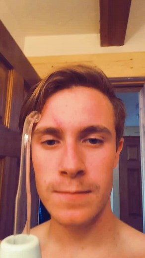 When your moms a dermatologist and let’s you zap your own pimples off #crazy #fyp