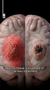 New Magnetic Blob Brain Tumor Treatment