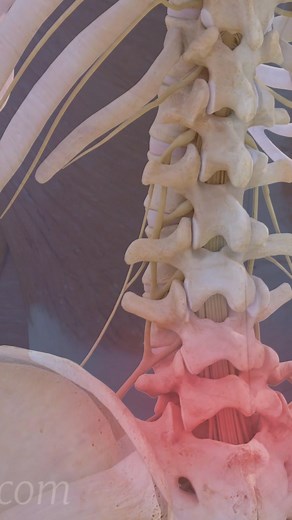 See how a L5-S1 degenerative disc causes pain. | Spine-health