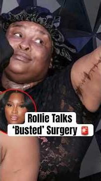 Rollie Talks 'Busted' Surgery #shorts #rolliepollie #baddies