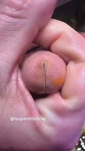 😳 interesting starfish!😭. . . . #funny #memes😂 #virals | El Pana Árabe