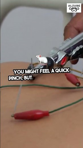 Step-by-Step EMG Testing for Nerve Damage - Unlocking Nerve Health | EMG Testing Guide