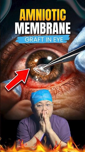 Placenta Used in Eye Treatment? Doctor Explains