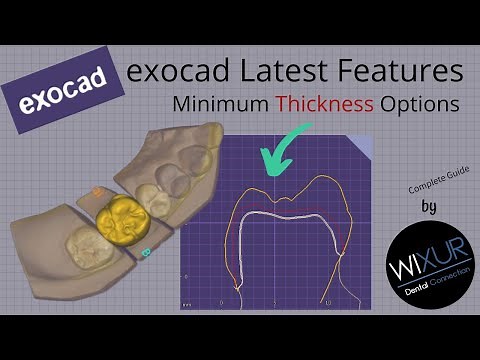 exocad Latest Features: Minimum Thickness Options