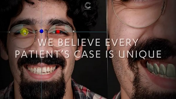 Digital Smile Design with Charismatic Dental Laboratory