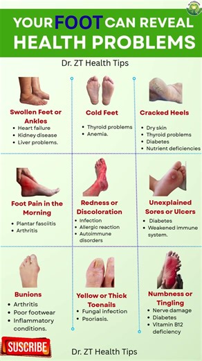 Your Foot Can Reveal Health Problem |Foot Warning Signs You Should Never Ignore|Dr. ZT’s Health Tips