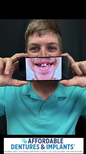 Upper Denture with 4 Lower implants (snap on denture) #affordabledentures #affordabledenturesandimplantslakemary #smile #confidence #teeth #teethtok #teethcare #dentures #denturesatayoungage #patientsatisfaction #dentist #snapon #snapondentures