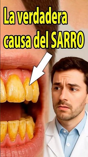 Best remedy against tartar