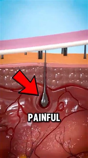 Why Waxing Hurts So Much