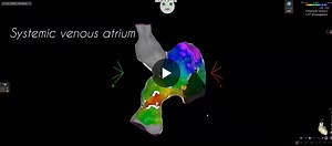 #epeeps #pulsedfieldablation #imaging #ultrasound #ct #ice #electrophysiology #cardiology | Copenhagen Heart Center Rigshospitalet-Gentofte Arrhythmia Group