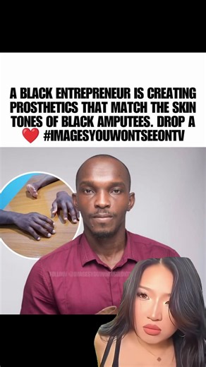 His Brother Lost His Fingers — So John Amanam Created Prosthetics for Black Skin ❤️