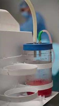 Why Marking Matters in Gynecomastia | Real Clinical Process