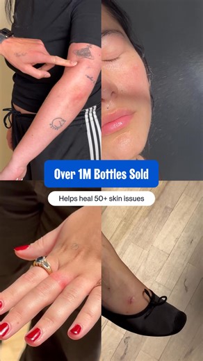  BIG NEWS  We dropped our prices. By A LOT. Why? Because we’ve grown really fast. Millions of bottles in just two years fast. And now we finally get to pass those savings on directly to you. 2 big bottles: $64 → Now just $36 That's $28 in savings! | Magic Molecule | Facebook