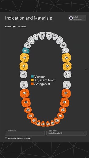 Training Session - exocad - Seth Potter