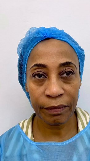 Full face @dracarmonard | Flawless Skin