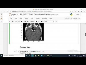 Brain Tumor Classification MRI | Brain Tumor Detection using Support Vector Machine in Python