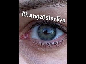 EYE COLOR CHANGE PERMANENTLY! +8G PLUS LASER!