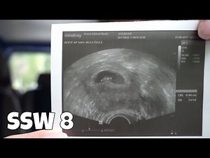 SSW 8 | Erste Ultraschalluntersuchung, Schwangerschaftsübelkeit [Schwangerschafts-Update]