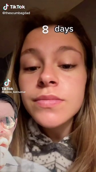 #greenscreen #greenscreenvideo @EMMA ARDITH TODHUNTER had jaw surgery and the healing process most commonly involves wiring the jaw shut for 6-8 weeks.