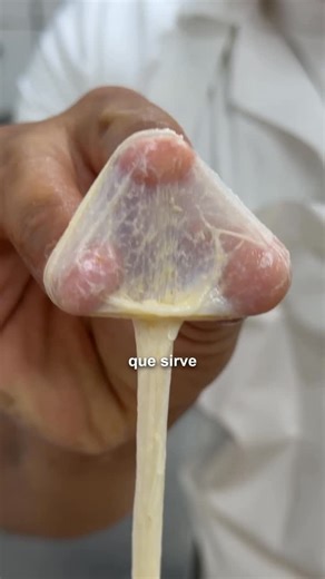 Maestro Charcutero - Academia on Instagram: "‼️ ESTÁ DEMÁS DECIR QUE ESTO ES PARA USO CASERO Y CONSUMO PROPIO | ESTÁ TÉCNICA JAMÁS VA A REEMPLAZAR PROTOCOLOS SANITARIOS OBLIGATORIOS PARA LA VENTA DE PRODUCTOS. 📌 INGREDIENTES 1,3 KG DE PALETA DE CERDO LIMPIA 2,5 KG DE SOBRECOSTILLA DE VACUNO 1,3 KG DE PAPADA DE CERDO 71 G DE SAL FINA 20 G DE PAPRIKA EN POLVO 10 G DE AJÍ PICANTE SECO 10 G DE PIMIENTA NEGRA MOLIDA 10 G COMINO 5 G DE ORÉGANO EN HOJA 5 DIENTES DE AJO MACHACADOS 500 ML VINO TINTO ‼️ 