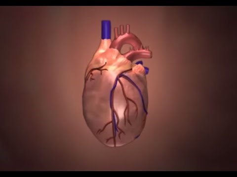 Kawasaki Disease: Animated Heart Video