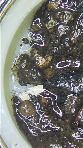 getting tap water under the microscope 🔬