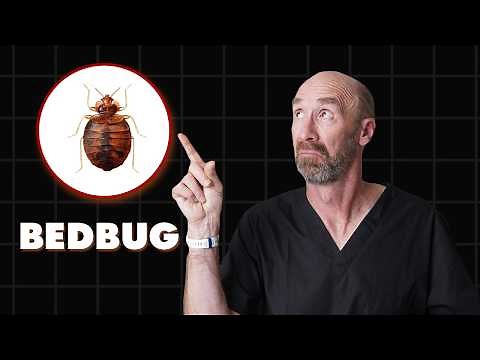 Doctor Explains BEDBUGS-including BITES, TREATMENT, REMOVAL