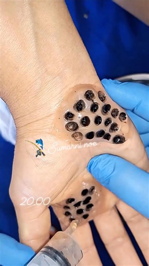 #tripofobia #fobia #Asmr #art | Sumarni Noe