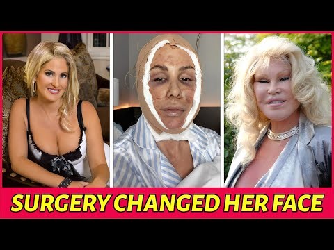 55 Most SHOCKING Plastic Surgery Transformations