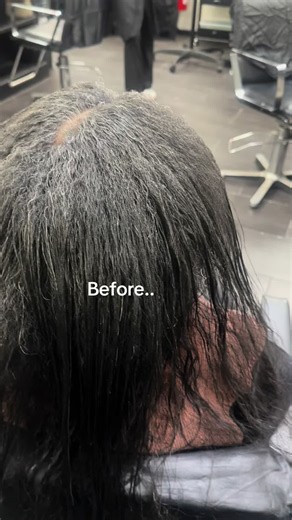 Hair Transformation: Full Head of Hair Before and After