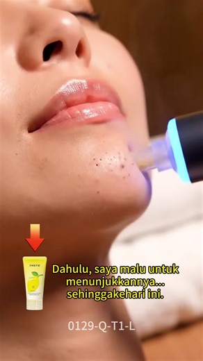 Effective Exfoliating Gel for Healthy Skin