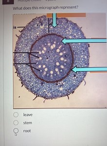 What does this micrograph represent?  A. leave B. stem C. root... | Filo