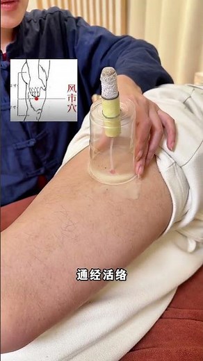 #Moxibustion for health preservation#Collection of Acupoints#The functions and benefits of