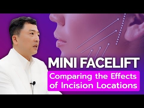 Comparing the Effects of Mini Facelift Incision Locations:
