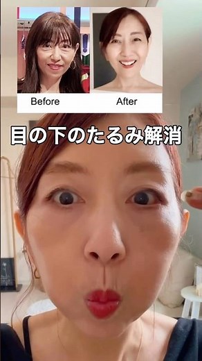 ✅目の下たるみ解消 ✅ゴルゴライン解消 ✅人中短縮トレーニング‼️