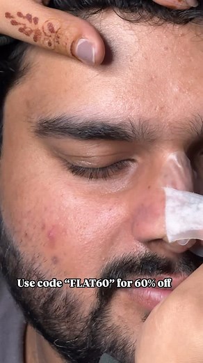 Makeup Artist | Beauty Content Creator on Instagram: "Achieve clearer, tighter-looking pores in just 6 hours with Pastel Jade Nose Pore Patches. Specially designed to target stubborn pores and pimples, these advanced hydrocolloid patches work while you sleep, absorbing excess oil and impurities to reveal fresh, clear skin by morning. Their gentle, non-drying formula is ideal for all skin types, including sensitive skin, and ensures a pain-free removal process with no leftover residue. Experience