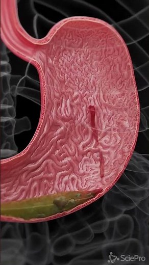 Inside Your Stomach: How It Actually Works 😮 | 3D Animation #3danimation #healthtips