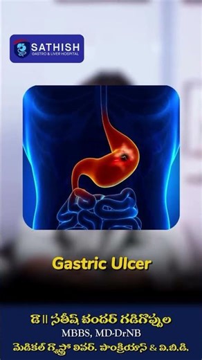 Struggling with Gas Problem? 😬 Here’s What Your Body Is Telling You