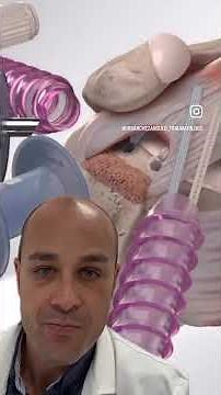 👨🏻‍⚕️ Rotura del supraespinoso del hombro - Así es la cirugía para recuperar la movilidad