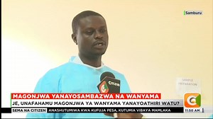 3.8K views · 89 reactions | Paka husambaza ugonjwa wa 'cat scratch disease' ambayo husababisha kujikuna #SemaNaCitizen | Citizen TV Kenya | Facebook