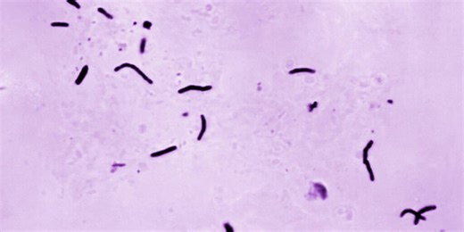 Former Anchorage jail ICE detainee denied asylum appeal, faces deportation with tuberculosis